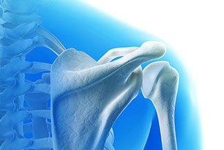 Arthroscopic subscapularis augmentation restored shoulder joint stability in athletes