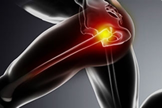 Common Causes of Hip Pain in the Athlete