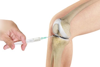 Does platelet-rich plasma for the knee work?