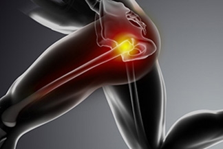 Gluteus Tendon Tears – A Common Cause of Hip Pain