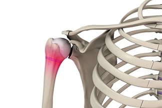 Little League Shoulder: Injury, Treatment and Most Importantly – Prevention