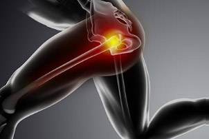 Proximal Hamstring Tendon Tears – A Common Cause of Hip Pain