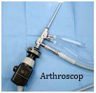 Arthroscopic Surgery