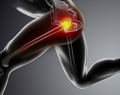 Common Causes of Hip Pain in Athletes