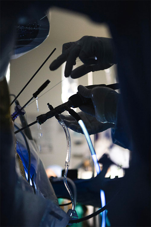 repair-a-hip-labrum-tear