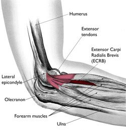 Tennis Elbow Anatomy